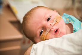 Bebê com catêter nasal - problemas respiratórios em crianças.